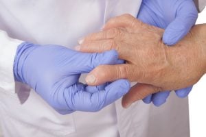 reumatologoi-arthritida